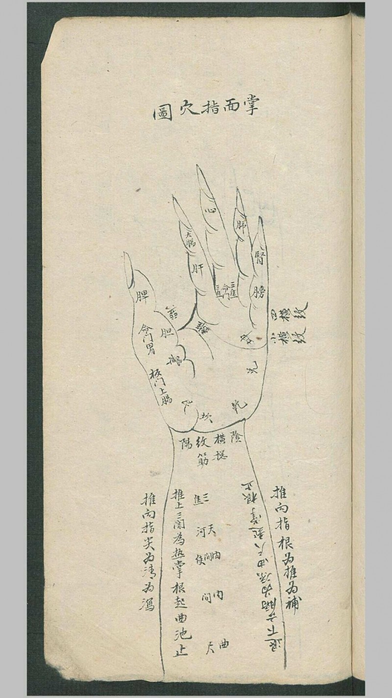 周于藩 宋驰化 丁芳溪 推拿纂正