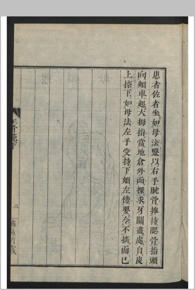 正骨范 2卷 , 1808