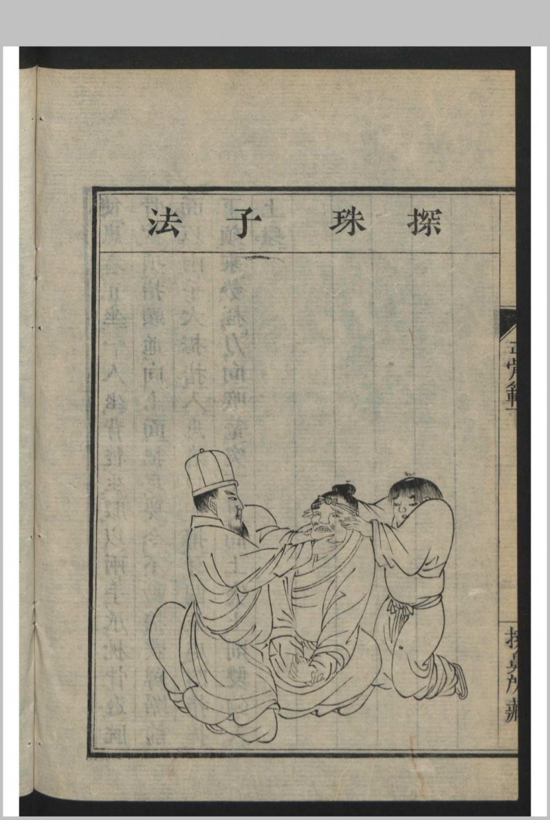 正骨范 2卷 , 1808