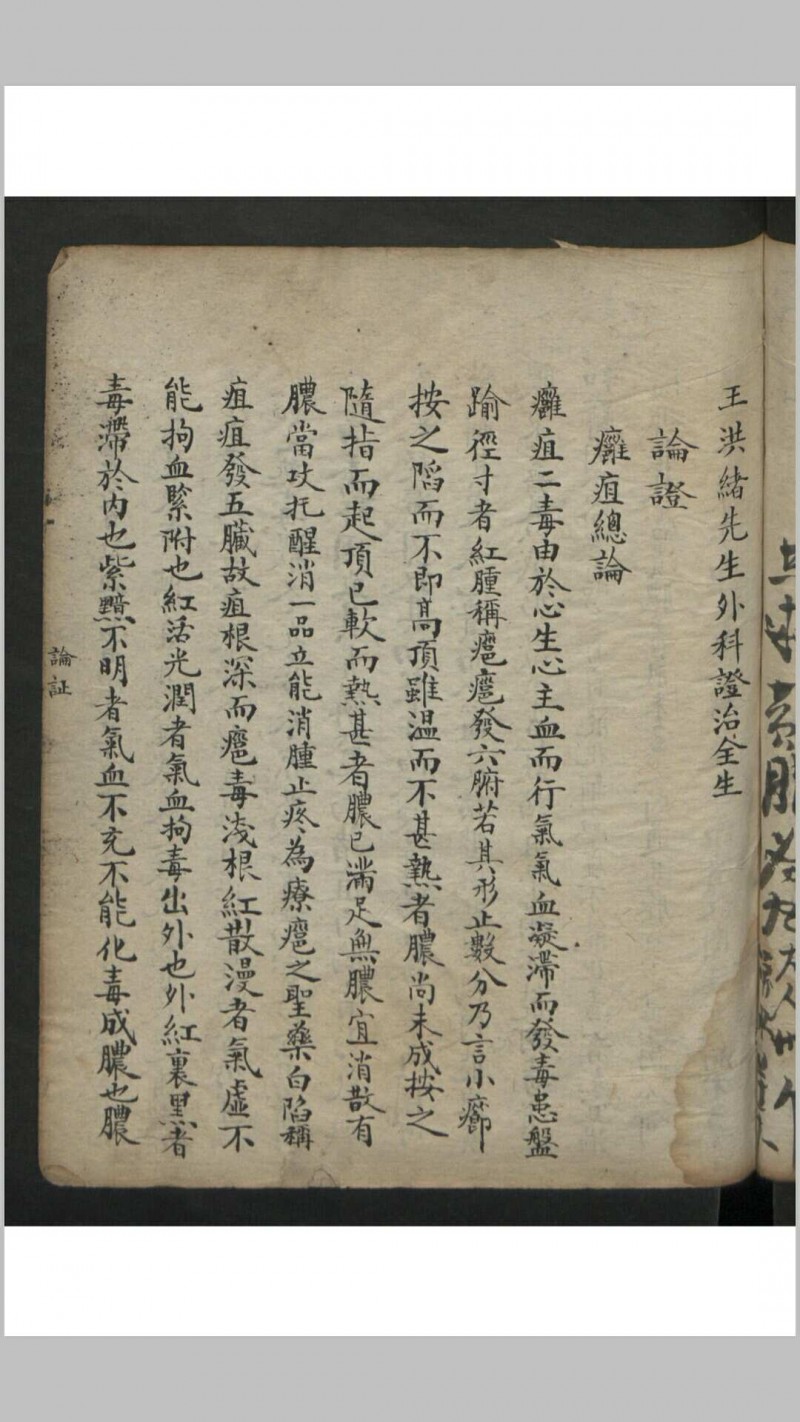 王维德 罗湖 外科证治全生集 , 1886