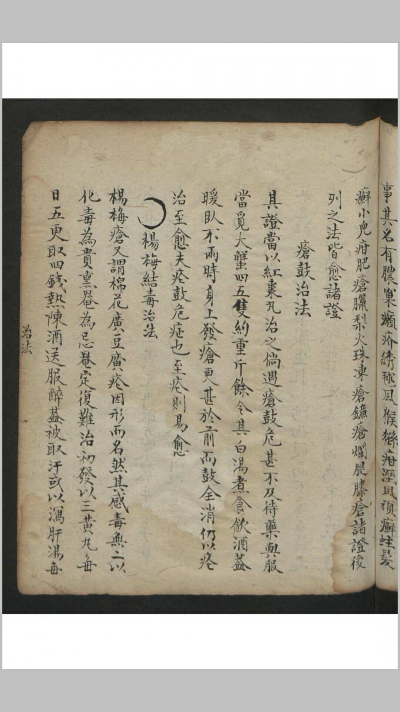 王维德 罗湖 外科证治全生集 , 1886