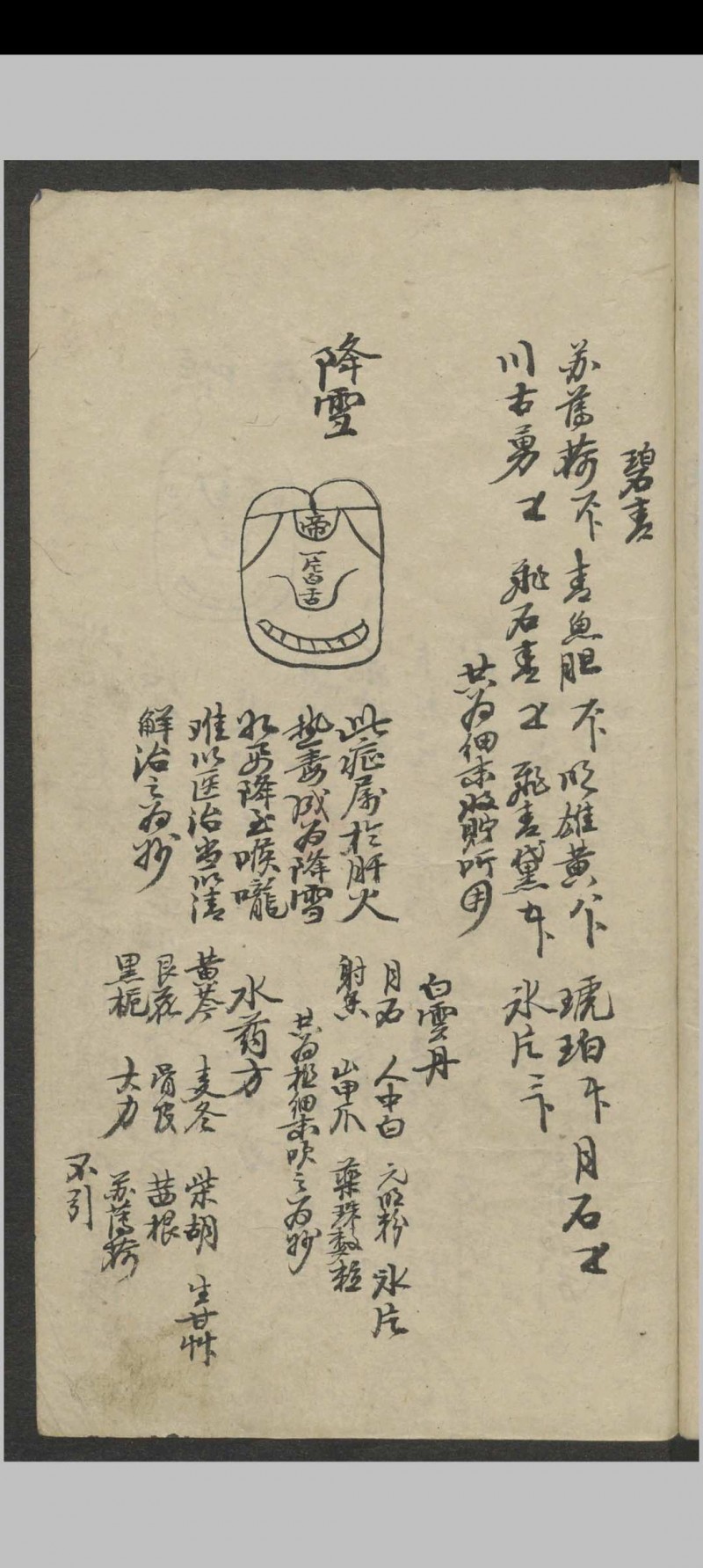 郑宏绩 秘传喉科   1900