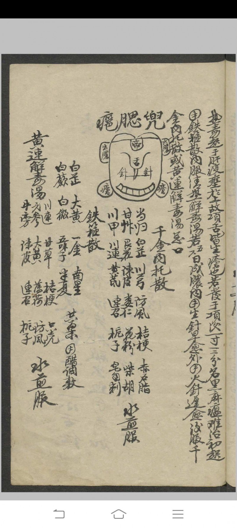 郑宏绩 秘传喉科   1900