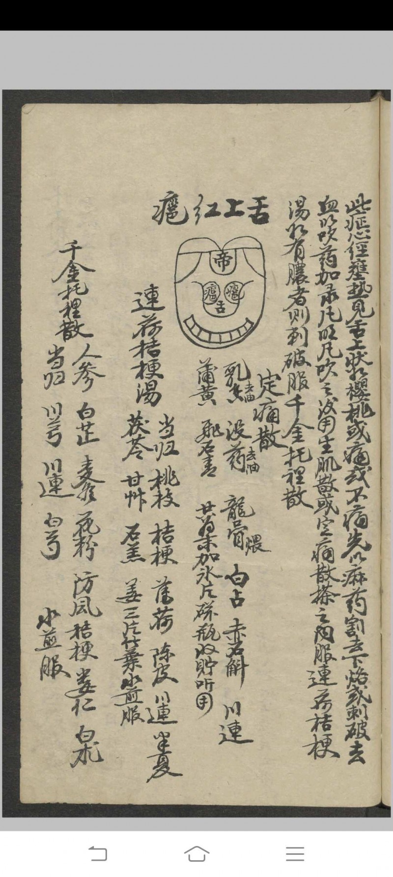 郑宏绩 秘传喉科   1900