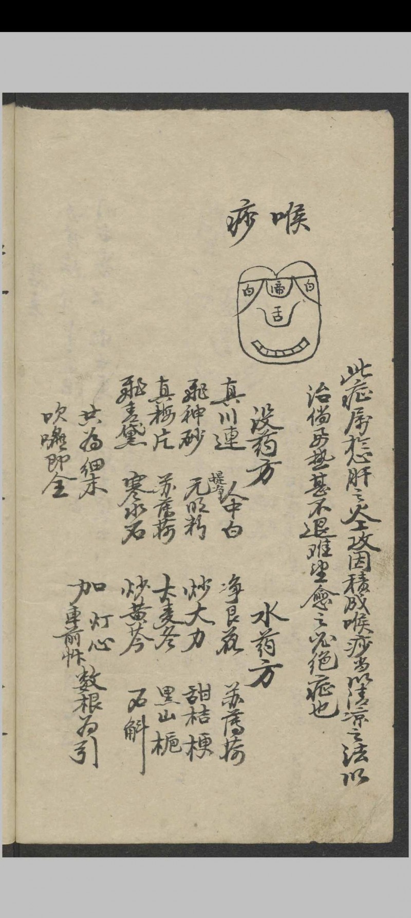 郑宏绩 秘传喉科   1900