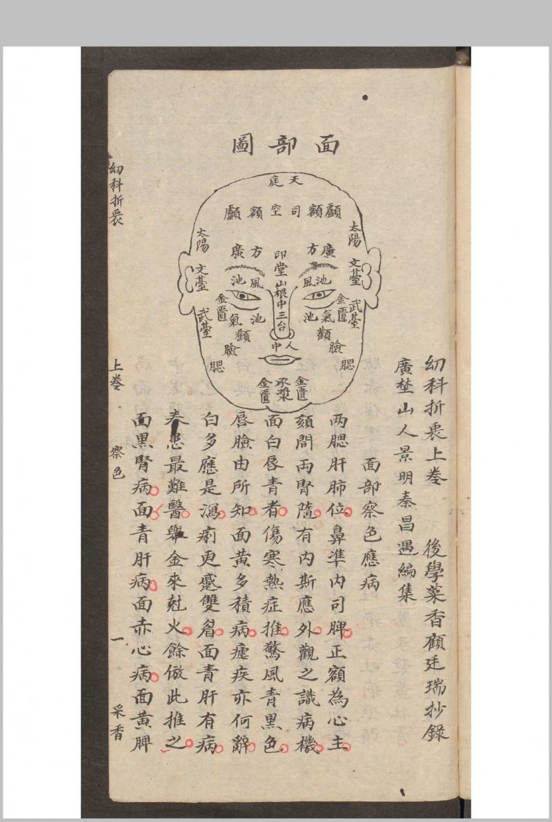 秦昌遇  顾廷瑞  幼科折衷 2卷 (存卷1) , 1875